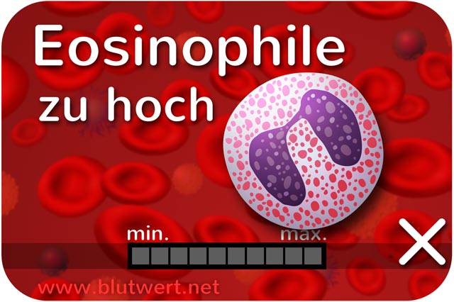 Zu viele eosinophile Granulozyten, Blutwert zu hoch: Eosinophilie
