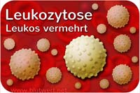 Leukozytose: zu viele Leukozyten