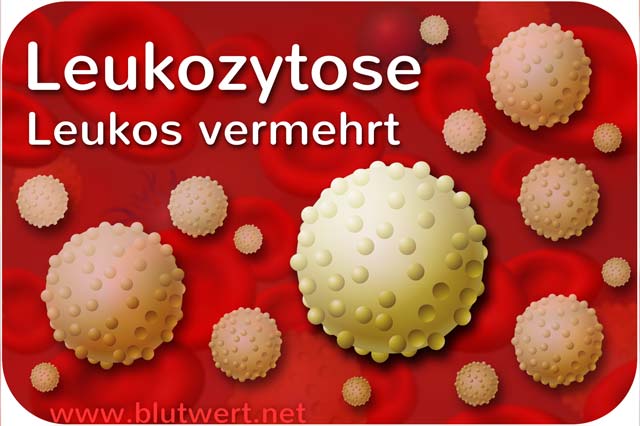 Leukozytose