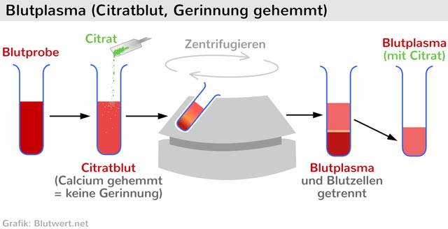 Blutplasma Gewinnung aus Citratblut